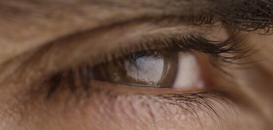 cernes yeux