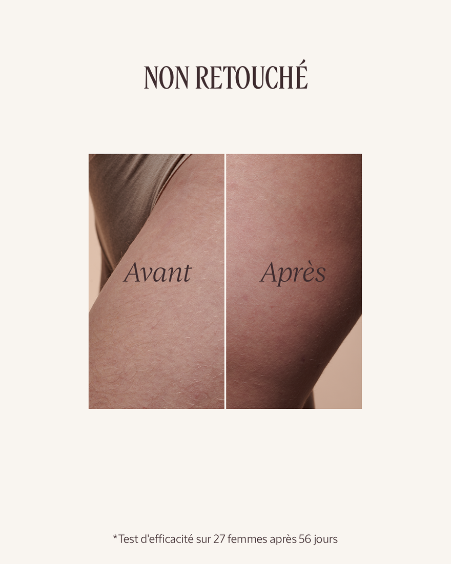 Affichage de l&rsquo;image 6/8 du produit Huile Souplesse Amande, , RECT